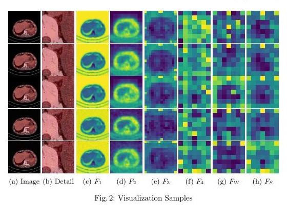 MS-IQA feature maps on PET/CT samples.
